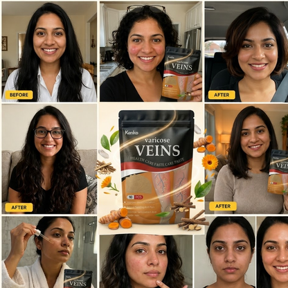 Varicose Veins Relief Patches (12 PCS)