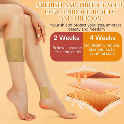 Varicose Veins Relief Patches (12 PCS)